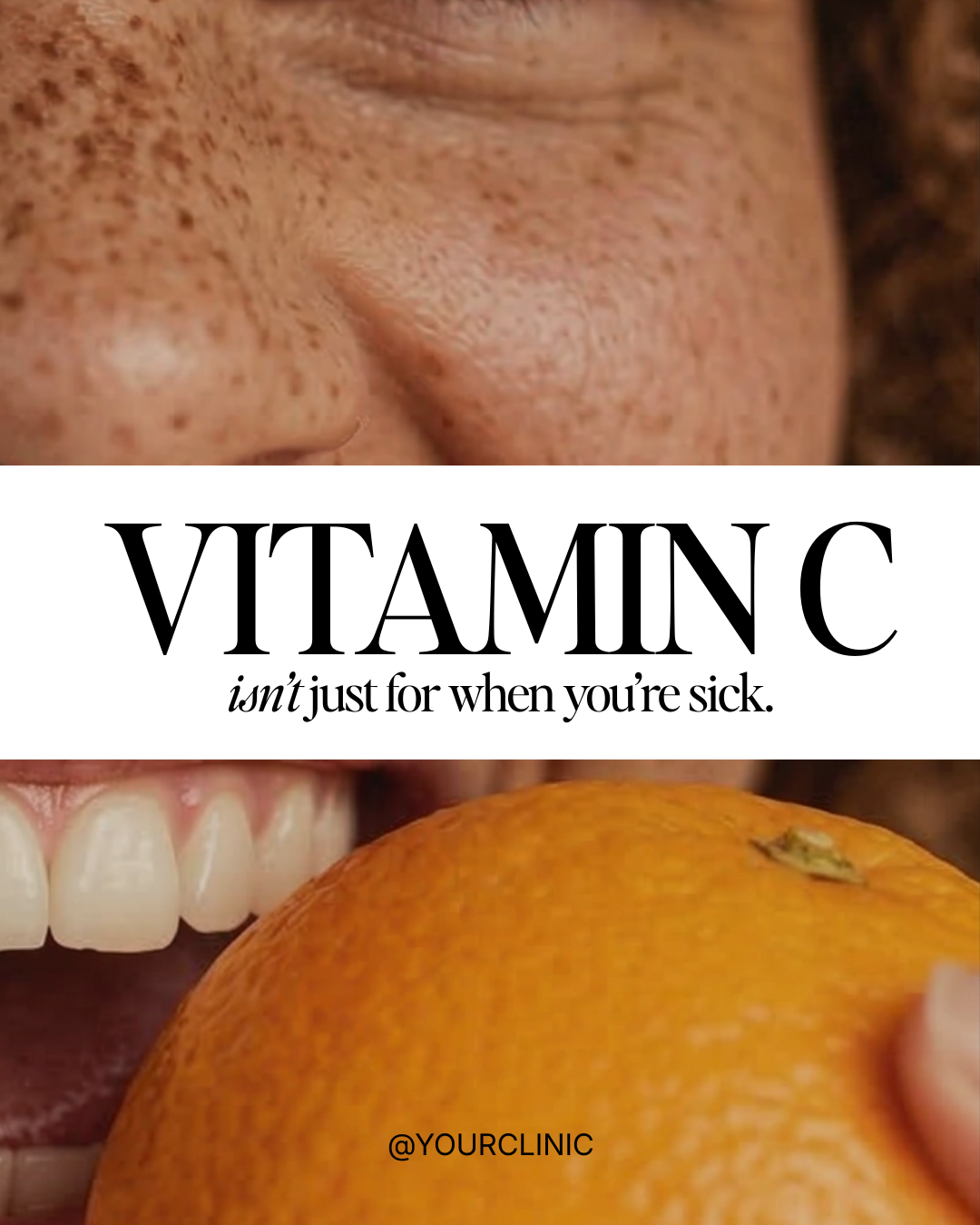 Vitamin C isn’t just for when you’re sick.